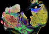 Spatial Proteomics Maps Head and Neck Tumors, Targets Biomarkers